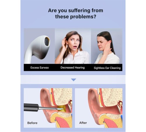 BEBIRD T5 3MP KAMERA 3.5MM LENS ŞARJLI WIFI GÖRÜNTÜLÜ KULAK TEMİZLEYİCİ SİYAH RENK