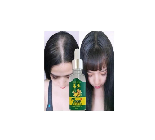 7 Days Ginger Germinal Essential Oil Hair Growth Loss Treatment Serum Unisex 30 ml 3 Adet 7 Days Ginger Germinal Essential Oil Hair Growth Loss Treatment Serum Unisex 30 ml 3 Adet