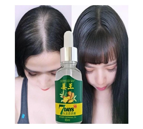 7Days 30ml Gingergerminalessentialoil Hair Growth Loss Treatment Serum Unisex 3 Adet Saç Bakım Yağı 7Days 30ml Gingergerminalessentialoil Hair Growth Loss Treatment Serum Unisex 3 Adet Saç Bakım Yağı