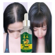 7Days 30ml Gingergerminalessentialoil Hair Growth Loss Treatment Serum Unisex 6 Adet Saç Bakım Yağı