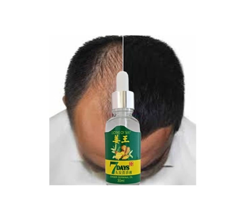 7Days 30ml Gingergerminalessentialoil Hair Growth Loss Treatment Serum Unisex Saç Bakım Yağı 7Days 30ml Gingergerminalessentialoil Hair Growth Loss Treatment Serum Unisex Saç Bakım Yağı