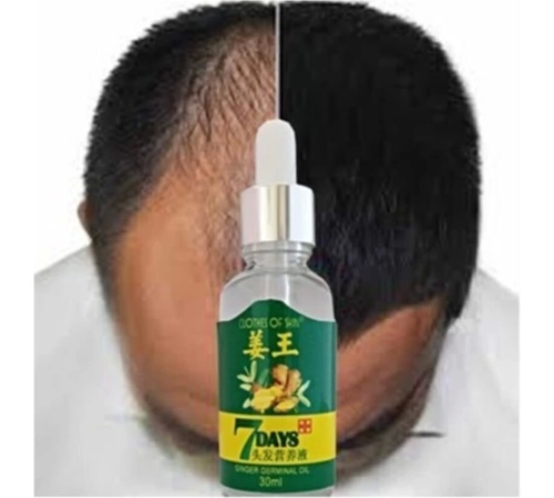 7days 7 Days 30ML Gingergerminalessentialoil Hair Growth Loss Treatment Serum Unisex 2 Adet Saç Bak