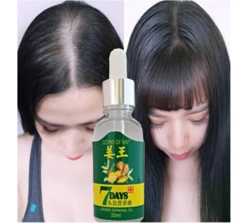 7days Ginger Germinal Essential Oil Hair Growth Loss Treatment Serum Uni 30ML 7days Ginger Germinal Essential Oil Hair Growth Loss Treatment Serum Uni 30ML