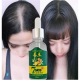 7days Ginger Germinal Essential Oil Hair Growth Loss Treatment Serum Uni 30ML