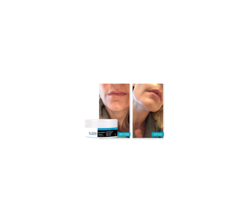 Dr Botokss Cildinizin Yeniden Yapılanması İçin Kırışıklık Giderci Bakım Kremi 50 ml x 2 adet Dr Botokss Cildinizin Yeniden Yapılanması İçin Kırışıklık Giderci Bakım Kremi 50 ml x 2 adet