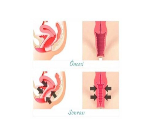 Kadınlar İçin Genital Bölge Şekillendirici Krem 100 ml X 2 ADET Kadınlar İçin Genital Bölge Şekillendirici Krem 100 ml X 2 ADET