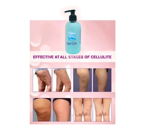 Lipo Cold Sıkılığa Inceliğe Hafifliğe Ve Selülilitlerinize Güçlü Etkide Krem 250 ml Lipo Cold Sıkılığa Inceliğe Hafifliğe Ve Selülilitlerinize Güçlü Etkide Krem 250 ml