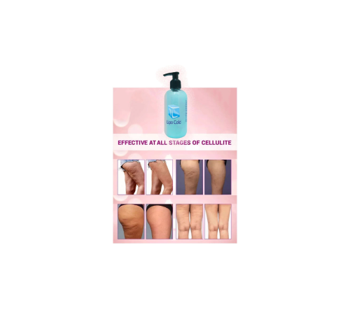 Lipo Cold Sıkılığınıza İnceliğinize Hafifliğinize Yeni Görünümünüze ve Selülilitlerinize Güçlü Krem 250 ml Lipo Cold Sıkılığınıza İnceliğinize Hafifliğinize Yeni Görünümünüze ve Selülilitlerinize Güçlü Krem 250 ml