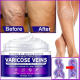 Maximum Strength Varicose Veins Krem 100 ml 1 Adt