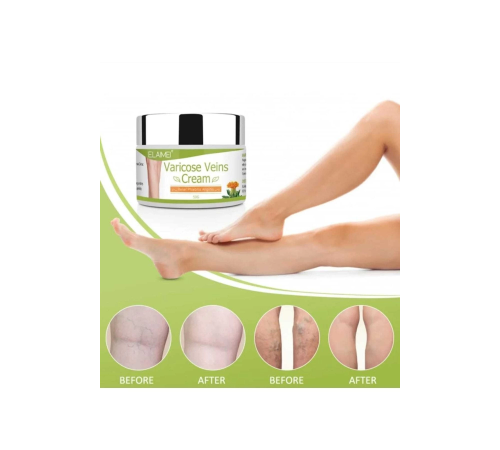Spider Varicose Veins Var.is Diz Bacak Ayak Bakım Kremi 1 Adet X 100 ml