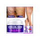 Strength Varicose Vein Tedavi Kremi 100 Ml