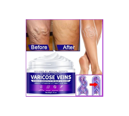 Strength Varicose Vein Tedavi Kremi 100 Ml X 3 ADET Strength Varicose Vein Tedavi Kremi 100 Ml X 3 ADET