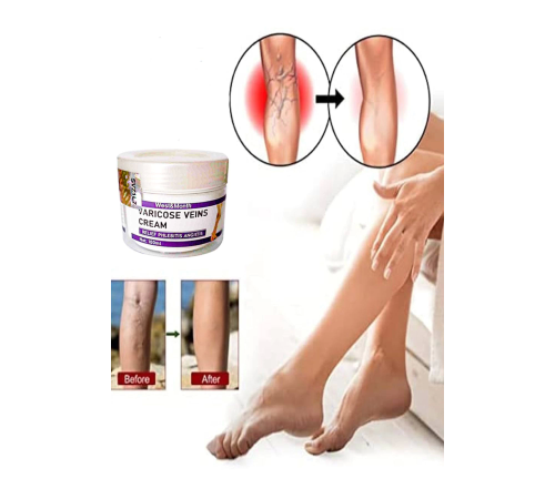 Varicose and Spider Veins Soothing Leg Cream Bacak Bakım Kremi 100 ml Varicose and Spider Veins Soothing Leg Cream Bacak Bakım Kremi 100 ml