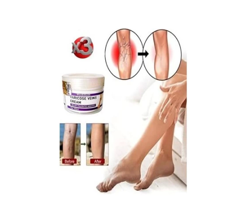 Varicose And Spider Veins Soothing Leg Cream Bacak Bakım Kremi 100 ml x 3 Adet Varicose And Spider Veins Soothing Leg Cream Bacak Bakım Kremi 100 ml x 3 Adet