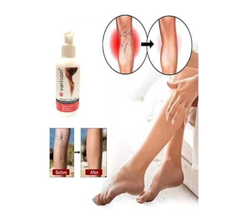 Varicose Vein Defense Var.is Bacak Bakım Kremi 120 Ml x 1 adet Varicose Vein Defense Var.is Bacak Bakım Kremi 120 Ml x 1 adet