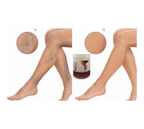 Varison Varicose Vein Defense Cream Diz Bacak Bakım Kremi 200ML+50ML Ayak Bakım Kremi Varison Varicose Vein Defense Cream Diz Bacak Bakım Kremi 200ML+50ML Ayak Bakım Kremi