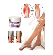 Varix Varicose Veins Purple Bakım Kremi 100 ml