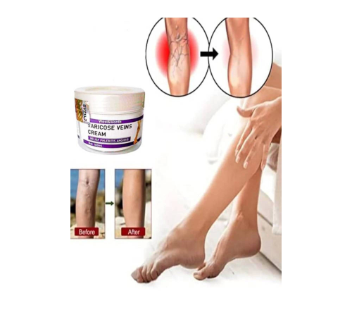 West & Month Varicose Vein Va.ris Karşıtı Kremi100 ml 2 Adet West & Month Varicose Vein Va.ris Karşıtı Kremi100 ml 2 Adet