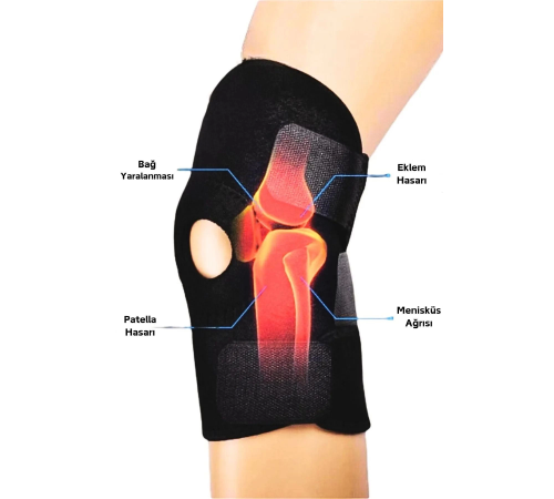 Diz Korsesi Çapraz Bağ Menisküs Ağrısı Için Dizlik Diz Bandajı Patella Dizlik Diz Korsesi Çapraz Bağ Menisküs Ağrısı Için Dizlik Diz Bandajı Patella Dizlik