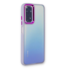 BFS  Xiaomi Redmi Note 11 Pro Kılıf Dora Kapak - Lila