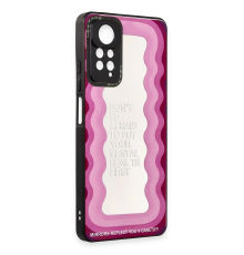 BFS  Xiaomi Redmi Note 11 Pro Kılıf Mirror Desenli Kapak - Mirror - 11