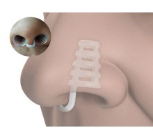 Horlama Burun Aparatı - Kafesli