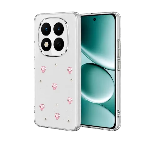Redmi Note 15 Pro 4G Fiyonk Desenli Kapak - Desen 3