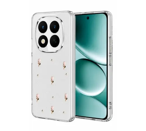 Redmi Note 15 Pro 4G Fiyonk Desenli Kapak - Desen 6