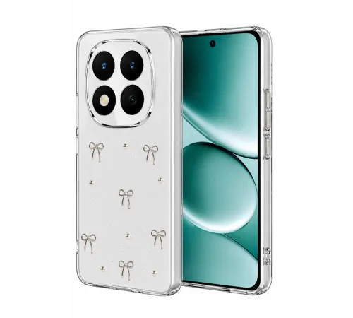 Redmi Note 15 Pro Plus 5G Fiyonk Desenli Kapak - Desen 5
