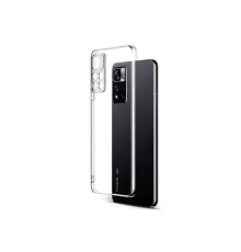 Xiaomi Redmi Note 11 Pro Plus 5G Kılıf Lüx Şeffaf Silikon