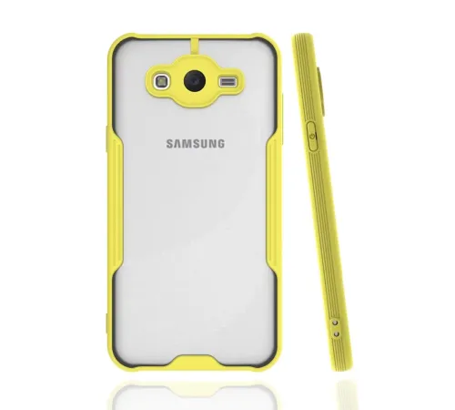 Samsung Galaxy J7 Kılıf Platin Silikon - Sarı