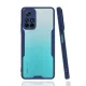 Xiaomi Redmi Note 11T Kılıf Platin Silikon - Lacivert