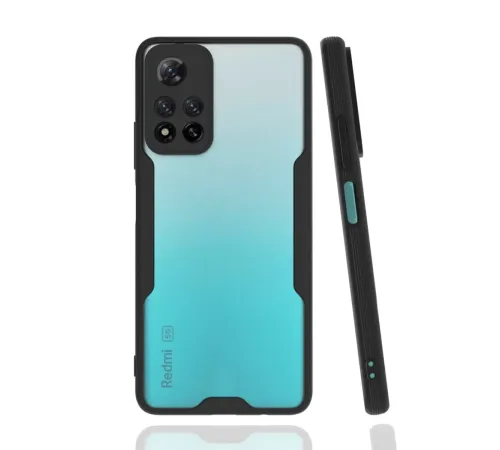 Xiaomi Redmi Note 11 Pro Plus 5G Kılıf Platin Silikon - Siyah