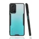 Xiaomi Redmi Note 11 Pro Plus 5G Kılıf Platin Silikon - Siyah