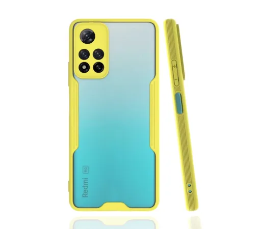 Xiaomi Redmi Note 11 Pro Plus 5G Kılıf Platin Silikon - Sarı