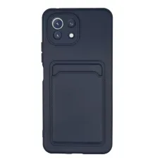 Xiaomi Mi 11 Kılıf Kelvin Kartvizitli Silikon - Lacivert