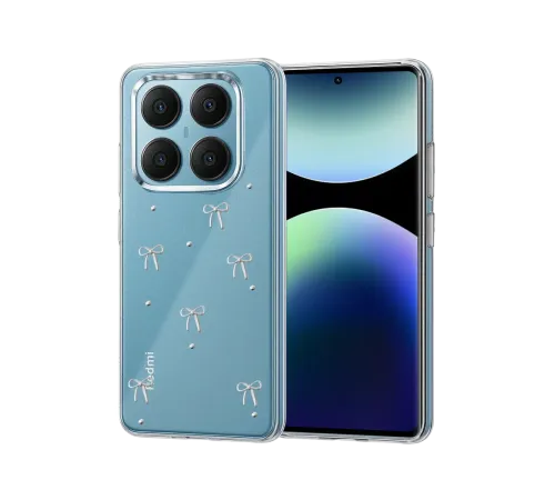 Xiaomi Redmi Note 14 Pro 4G Fiyonk Desenli Kapak - Desen 5