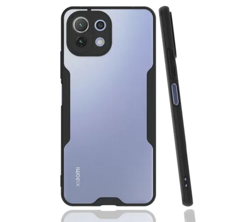 Xiaomi Mİ 11 Lite Kılıf Platin Silikon - Siyah