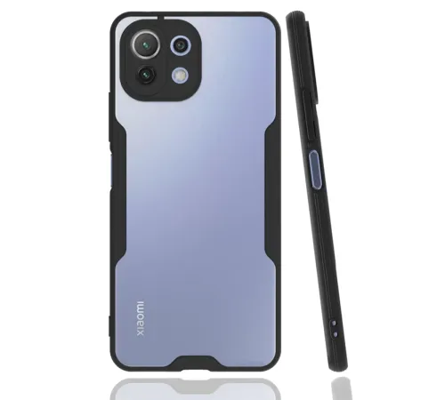 Xiaomi Mİ 11 Lite Kılıf Platin Silikon - Siyah