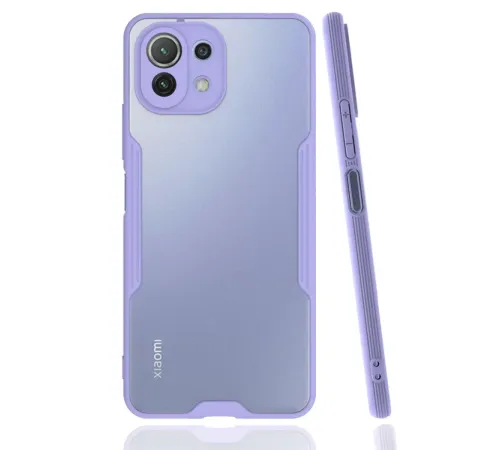 Xiaomi Mİ 11 Lite Kılıf Platin Silikon - Lila