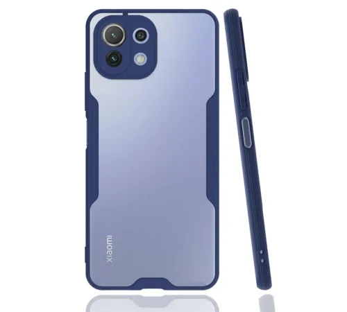 Xiaomi Mİ 11 Lite Kılıf Platin Silikon - Lacivert