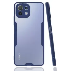 Xiaomi Mİ 11 Lite Kılıf Platin Silikon - Lacivert