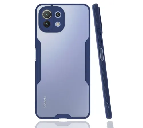 Xiaomi Mİ 11 Lite Kılıf Platin Silikon - Lacivert