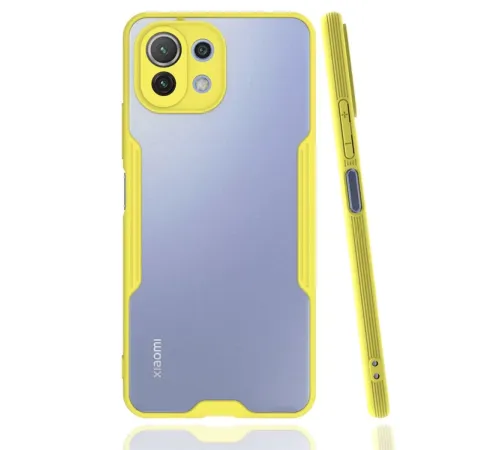 Xiaomi Mİ 11 Lite Kılıf Platin Silikon - Sarı