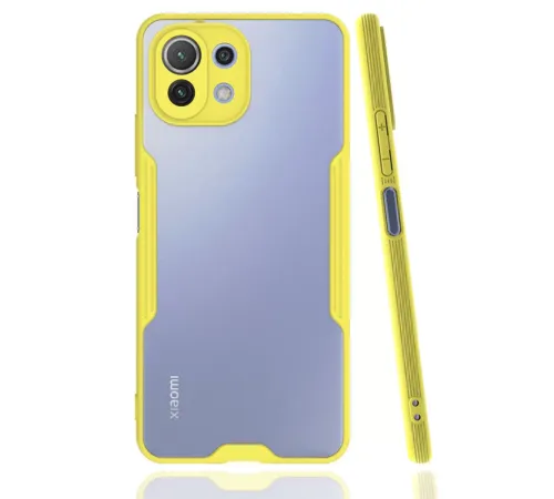 Xiaomi Mİ 11 Lite Kılıf Platin Silikon - Sarı