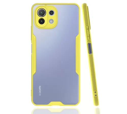 Xiaomi Mİ 11 Lite Kılıf Platin Silikon - Sarı