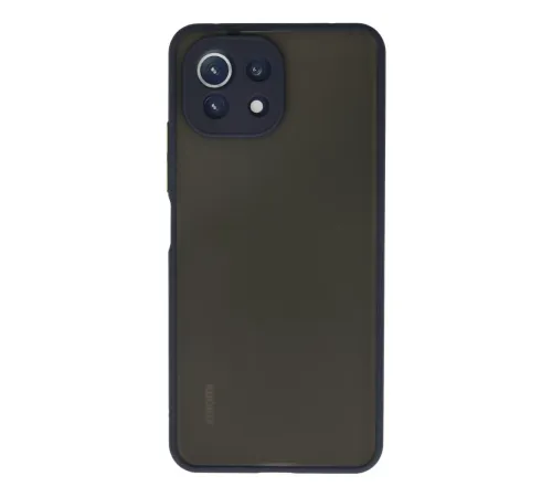 Xiaomi Mİ 11 Lite Kılıf Montreal Silikon Kapak - Lacivert