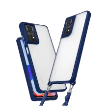 Xiaomi Redmi Note 11 Pro Kılıf Penta Silikon Kılıf - Lacivert