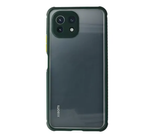 Xiaomi Mİ 11 Lite Kılıf Miami Şeffaf Silikon - Koyu Yeşil