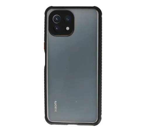 Xiaomi Mİ 11 Lite Kılıf Miami Şeffaf Silikon - Siyah